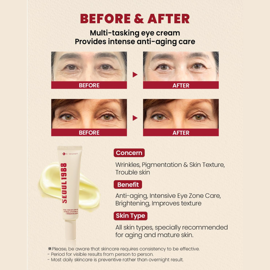 K-Secret Seoul 1988 Eye Cream 30ml - Image 2